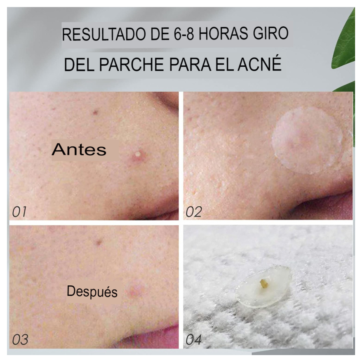 Parches Médicos Para Acné 120 Pcs
