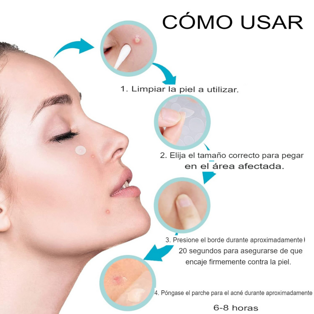Parches Médicos Para Acné 120 Pcs